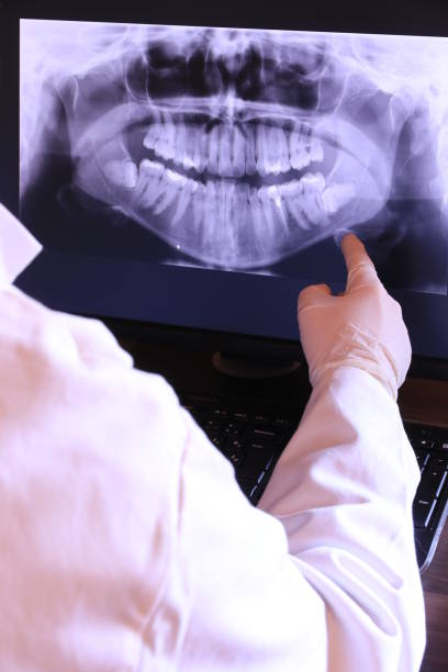 Best Emergency Treatment for Dental Infections or Abscesses in Mount Juliet, TN